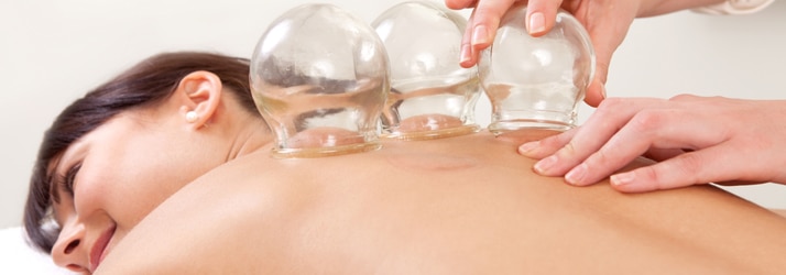 Chiropractic Lakewood CO Cupping